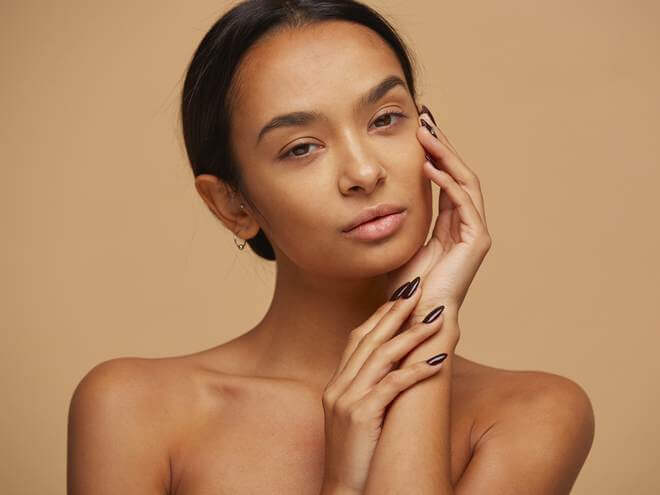 Melasma: aprenda a prevenir e tratar esse incômodo