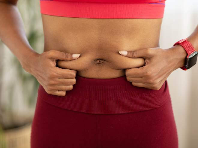 flacidez abdominal